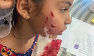 पागल कुत्ते ने मासूम के गाल और जबड़े पर आई गंभीर चोंट   कुत्ते के हमले में घायल हुई मासूम।