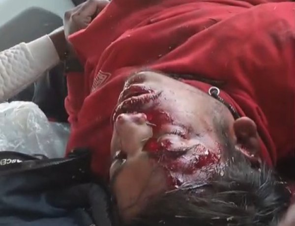 डिवाइडर से टकराई बाइक युवक गम्भीर घायल इंदौर रेफर